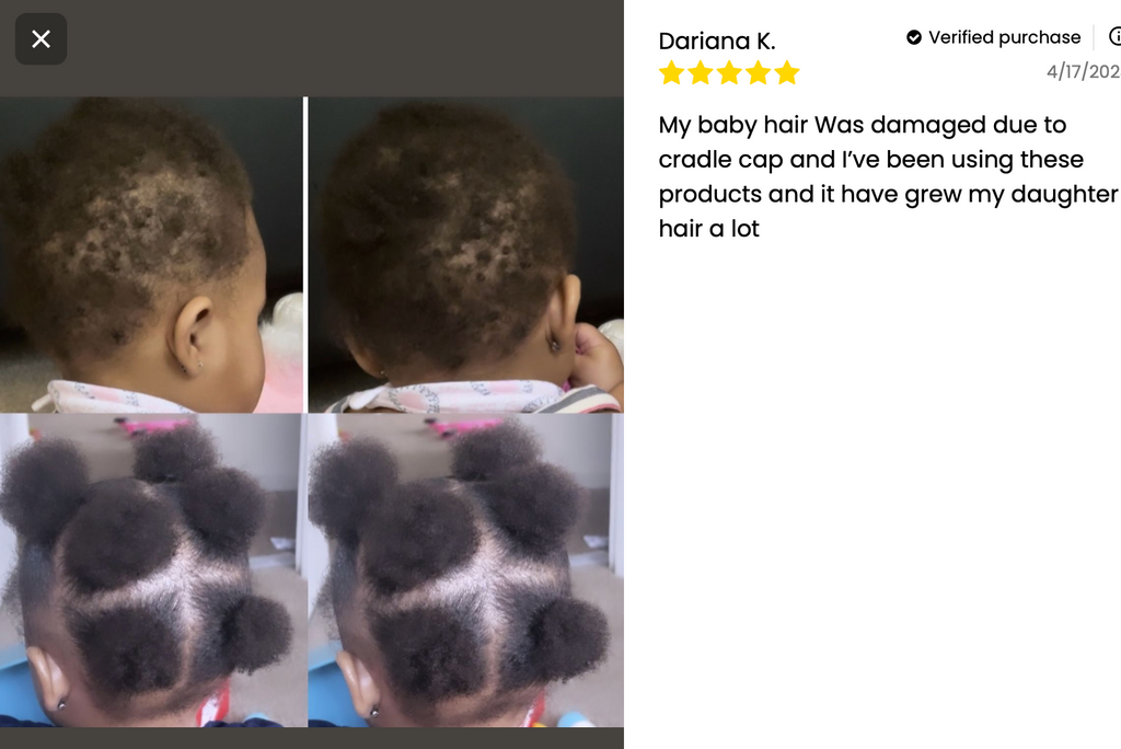 Kids' Scalp Pomade for Curly, Coily & 4C Hair
