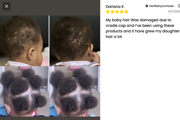 Kids' Scalp Pomade for Curly, Coily & 4C Hair