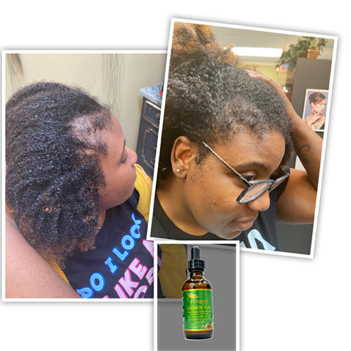 J Organic solutions Growth-Plus Hair Oil