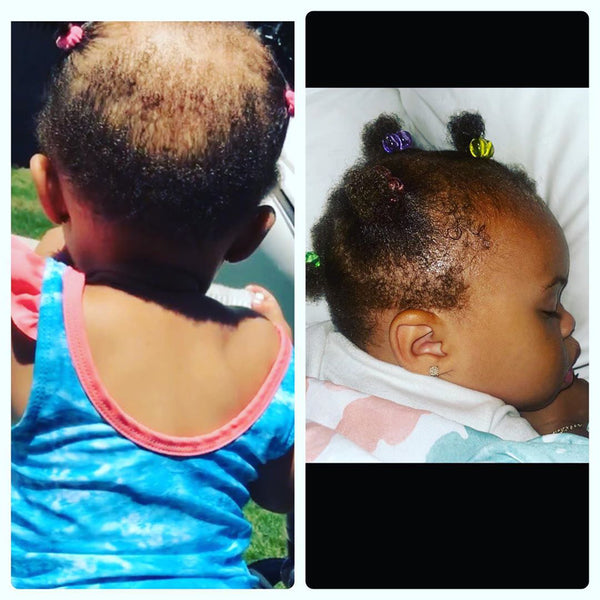 Kids' Super Healthy Hair Kit — Complete 5-Step Wash Day Routine for Curly, Coily & 4C Hair